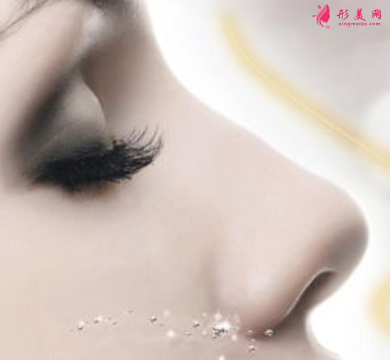 假體隆鼻恢復(fù)期長(zhǎng)嗎