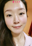 想要變白去皺滿臉膠原蛋白？西京醫(yī)院熱瑪吉統(tǒng)統(tǒng)實現(xiàn)