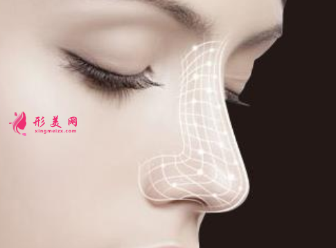 假體隆鼻術(shù)后會留下疤痕嗎