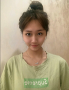 南京華美美容醫(yī)院面部填充怎么樣？脂肪填充后的減齡臉打卡！