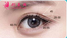開眼角大概什么時候能恢復(fù)