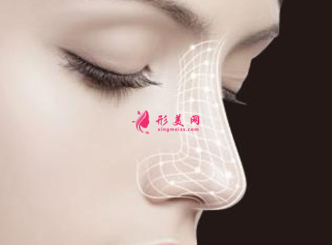 肋軟骨隆鼻一般要多少錢
