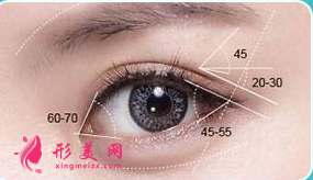 開(kāi)眼角術(shù)后護(hù)理需要注意什么