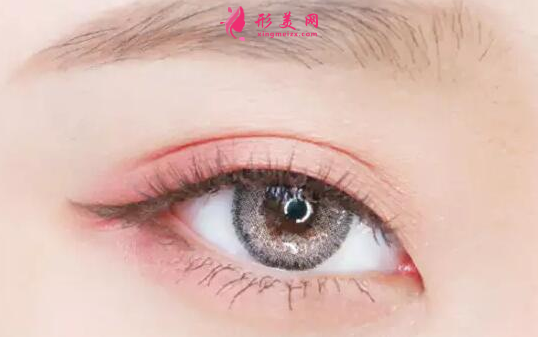 開眼角手術(shù)要多長時間