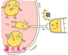 吸脂減肥什么時(shí)候可以恢復(fù)正?；顒?dòng)？