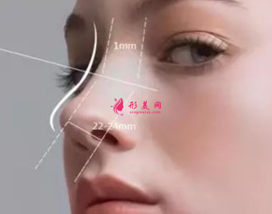 軟骨隆鼻的效果能維持多久