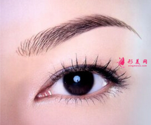 開眼角出現(xiàn)明顯疤痕的原因是什么