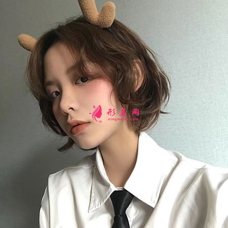 北京藝美面部吸脂案例術后39天