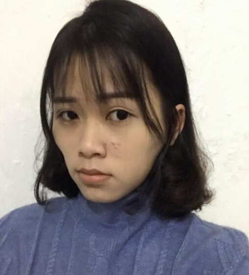 上海九院顴骨內(nèi)推多少錢？全新價格表來襲！附案例分享