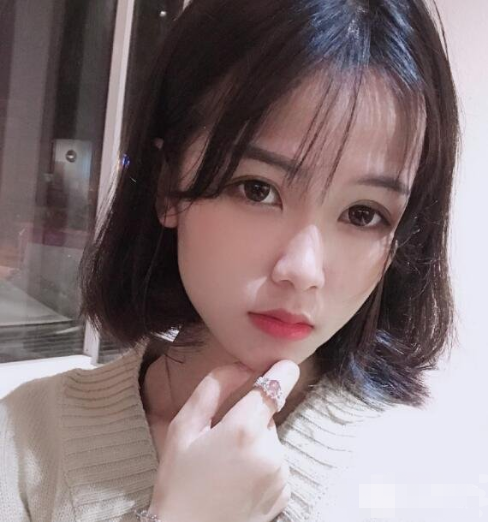 上海九院顴骨內(nèi)推多少錢？全新價格表來襲！附案例分享