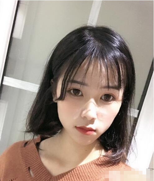 上海九院顴骨內(nèi)推多少錢？全新價格表來襲！附案例分享
