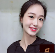 上海伯思立做鼻子怎么樣呢？術(shù)后90天案例分享