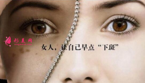 激光祛斑要多少天恢復(fù)好