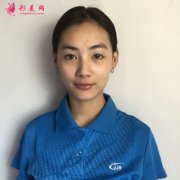 上海九院整形科怎么樣？雙眼皮手術(shù)全程恢復(fù)真實記錄