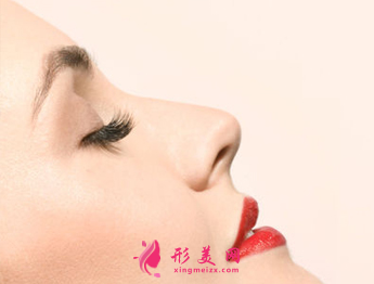 自體軟骨隆鼻效果可以長(zhǎng)久保持嗎
