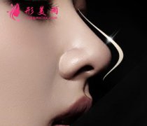 自體軟骨隆鼻常見的軟骨材料