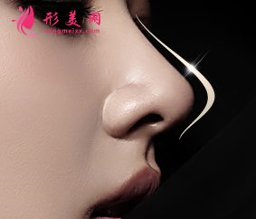 自體軟骨隆鼻常見的軟骨材料