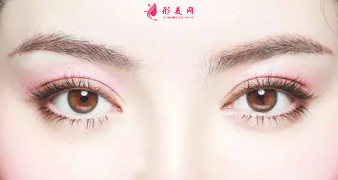 雙眼皮術(shù)后恢復(fù)的快慢跟什么有關(guān)