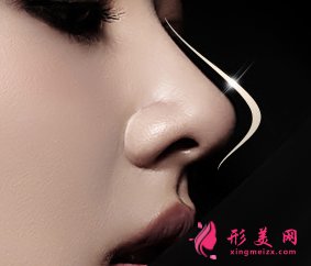 假體隆鼻術(shù)后的相關(guān)護(hù)理事項(xiàng)有哪些