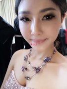 開眼角手術大約需要多少錢？
