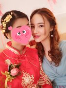 自體軟骨隆鼻術后護理工作怎么做？
