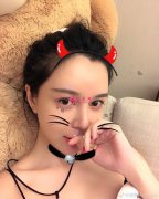 開眼角手術(shù)后如何護理呢？