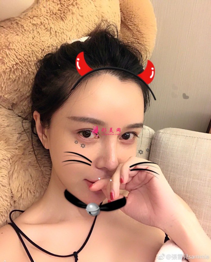 開眼角手術(shù)后如何護(hù)理呢