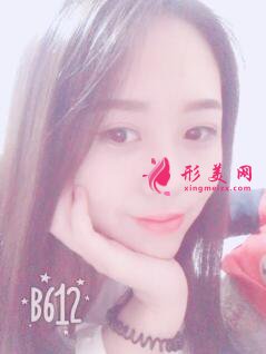 自體軟骨隆鼻術(shù)后遺癥有哪些？注意事項也很重要~