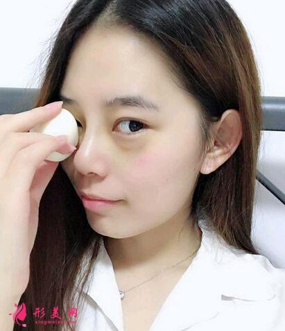 眼部整形手術(shù)價錢是多少？術(shù)后注意事項是什么？