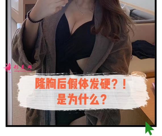 假體隆胸術(shù)后假體發(fā)硬怎么辦.jpg