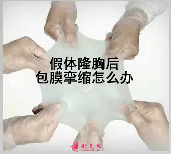 假體隆胸后包膜攣縮怎么辦.jpg