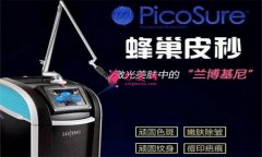 如何治療雀斑？激光祛斑貴嗎？