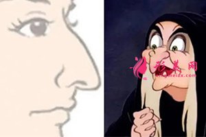 鼻子下垂 鼻子下垂