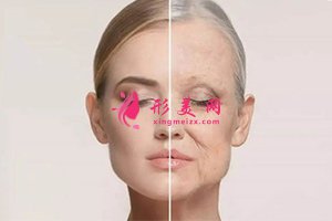 皮膚松弛對比圖 皮膚松弛對比圖