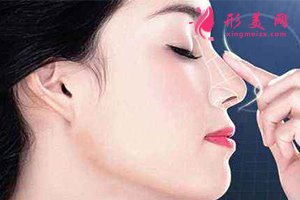 自體隆鼻 自體隆鼻
