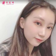 成都圣丹福整形醫(yī)院雙眼皮價(jià)格表2021更新中！還有案例效果參考哦