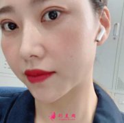 濟(jì)南海峽醫(yī)院去眼袋價(jià)格多少？案例和2021收費(fèi)標(biāo)準(zhǔn)一起看