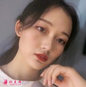 重慶西南醫(yī)院整形外科隆鼻失敗修復(fù)案例~術(shù)后兩個(gè)月效果分享