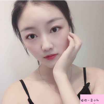 上海九院整形科蘇薇潔雙眼皮怎么樣？真實(shí)案例和價格表一起瞧瞧~
