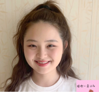 上海伯思立醫(yī)療美容正規(guī)嗎?附瘦臉針前后對(duì)比圖一覽