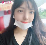重慶星榮整形外科醫(yī)院雙眼皮怎么樣？看成功雙眼皮案例~照片反饋