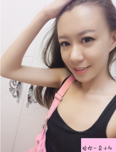 北京純脂馮斌脂肪填充怎么樣?看看術(shù)后效果怎么樣?