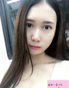 南京江寧鼻祖醫(yī)療美容隆鼻怎么樣？來看看術(shù)后案例吧