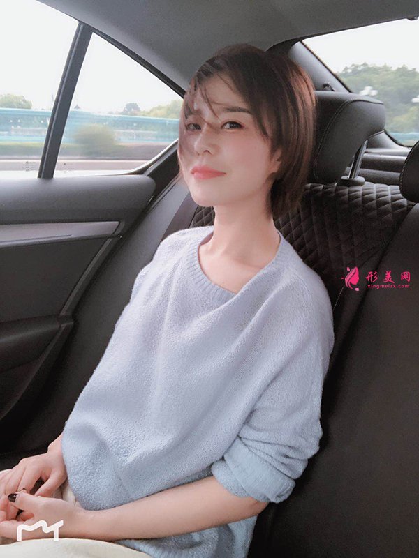 上海華美醫(yī)療美容醫(yī)院徐文龍醫(yī)生膨體隆鼻案例