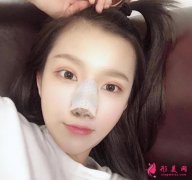 北京協(xié)和醫(yī)院整形科隆鼻怎么樣？參考案例+價格表一覽