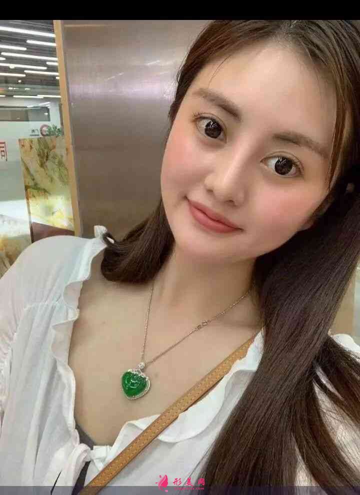 北京畫美醫(yī)療美容醫(yī)怎么樣？2021價(jià)格表公布+玻尿酸豐唇案例分享