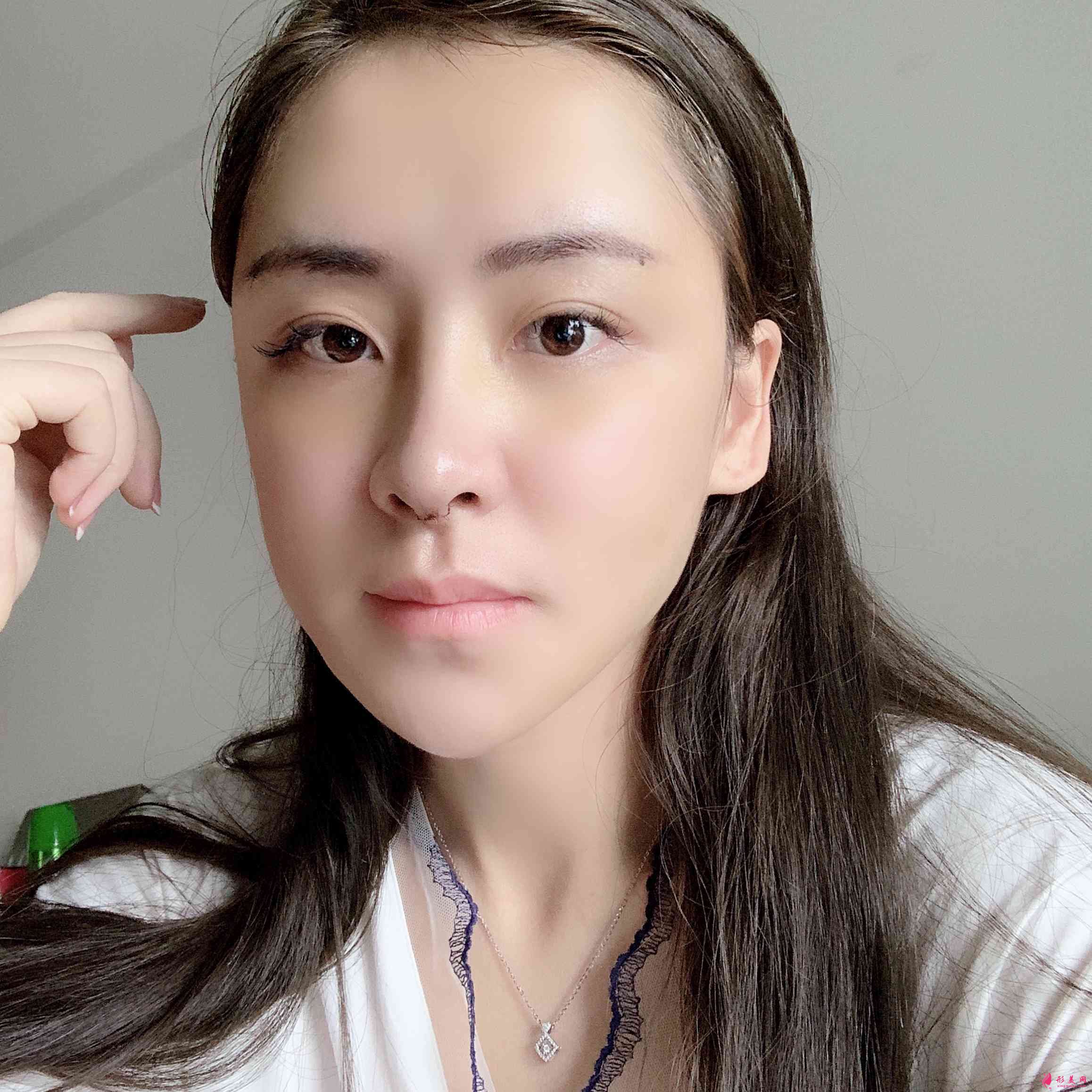 深圳富華美容醫(yī)院口碑怎么樣？2021價格表公開+鼻修復(fù)案例分享