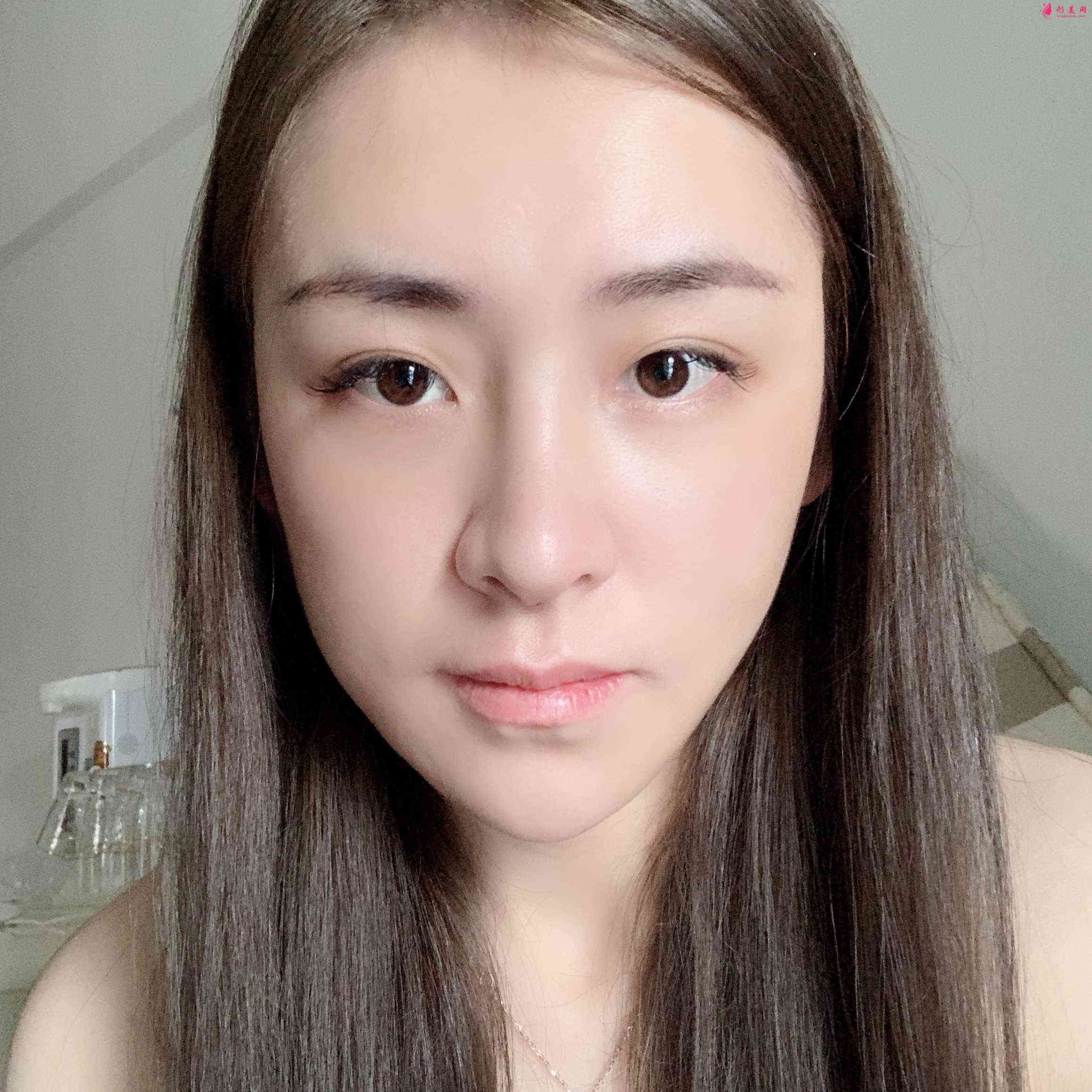 深圳富華美容醫(yī)院口碑怎么樣？2021價格表公開+鼻修復(fù)案例分享