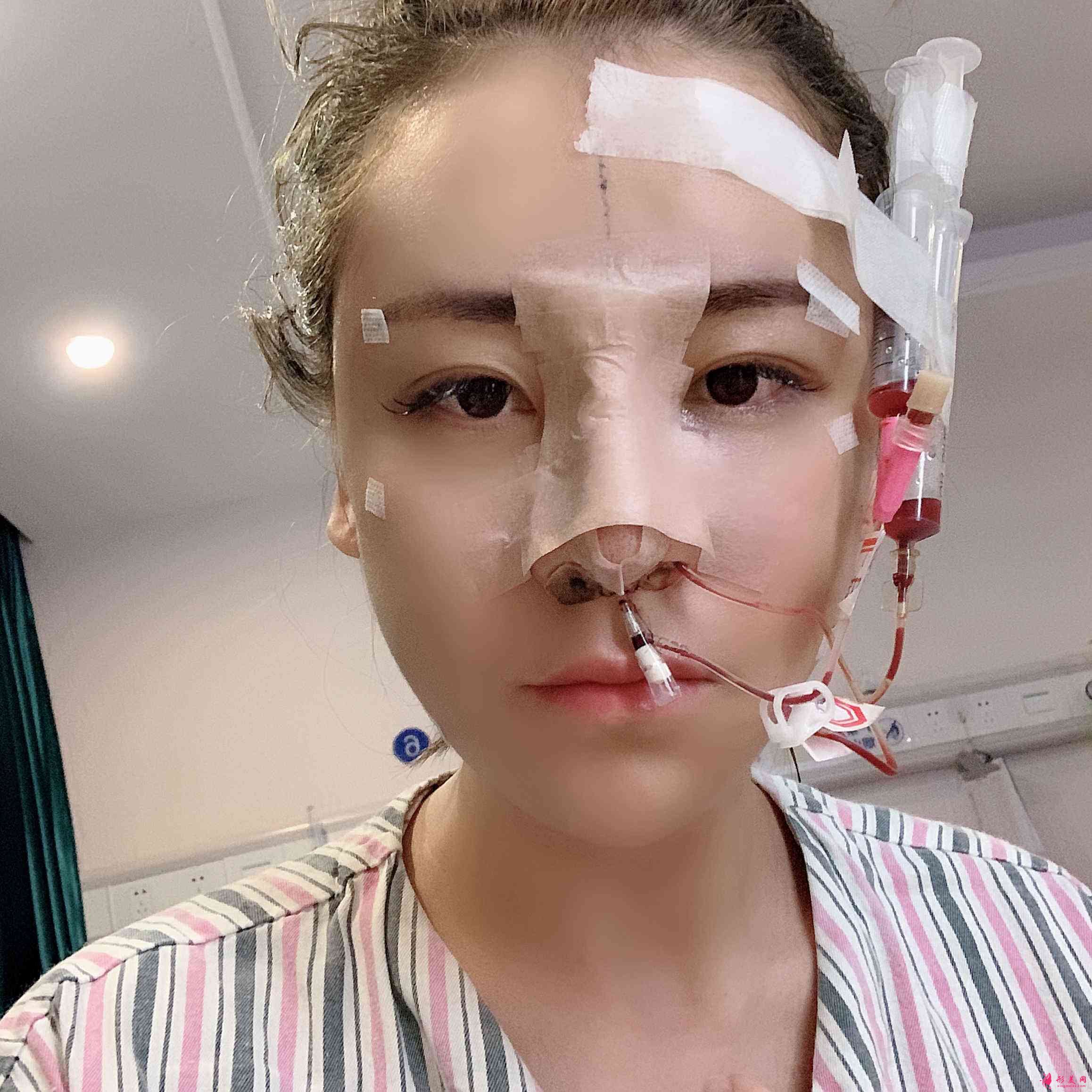 深圳富華美容醫(yī)院口碑怎么樣？2021價格表公開+鼻修復(fù)案例分享
