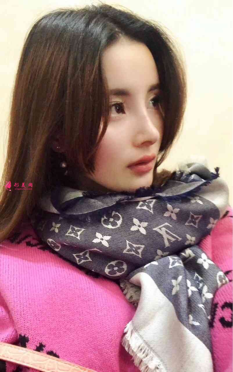 北京壹加壹醫(yī)院正規(guī)嗎？附隆鼻案例及2021價(jià)格表發(fā)布